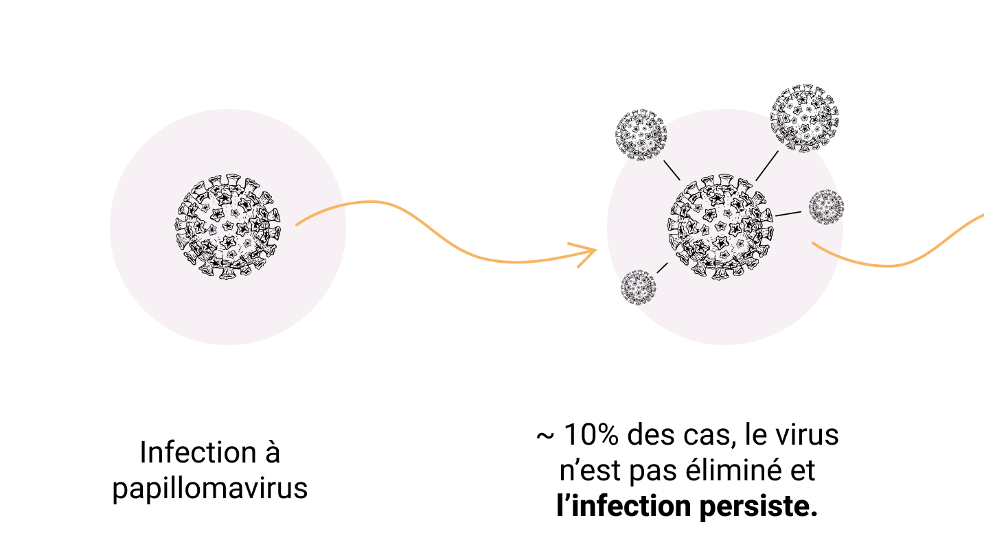 icone papillomavirus qui évolue en cancer