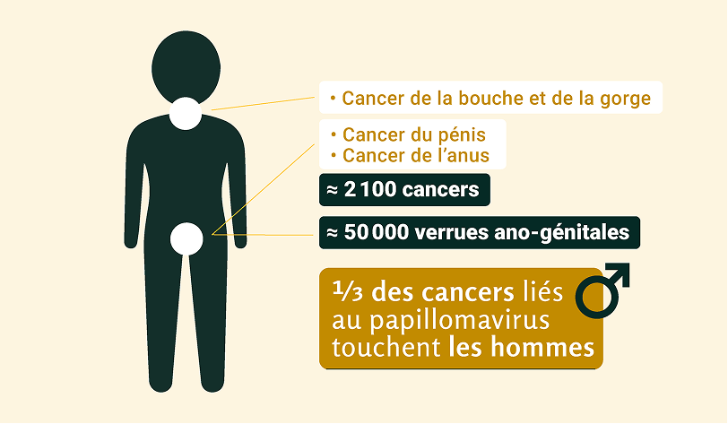 Infographie cancers papillomavirus chez les hommes 