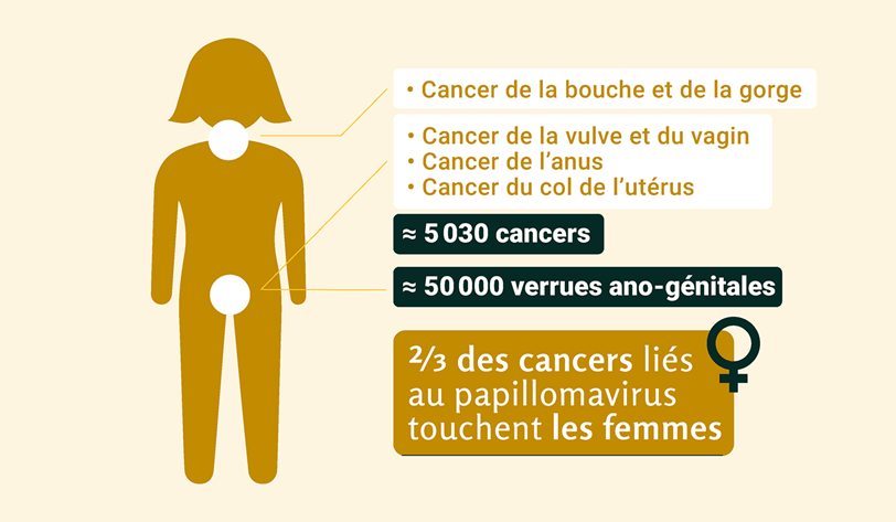 Infographie cancers papillomavirus chez les femmes
